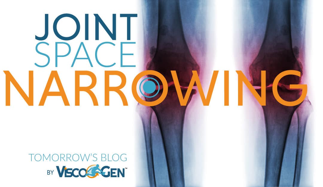 Joint Space Narrowing (JSN) and Knee Pain
