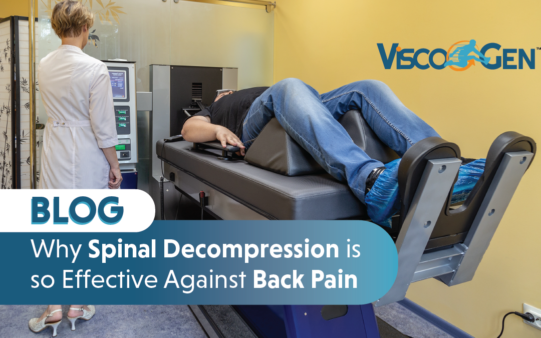 why spinal decompression is so effective against back pain - blog - ViscoGen™