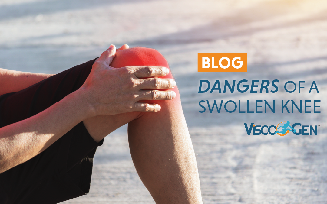 ViscoGen - Blog - Dangers Of Swollen Knees