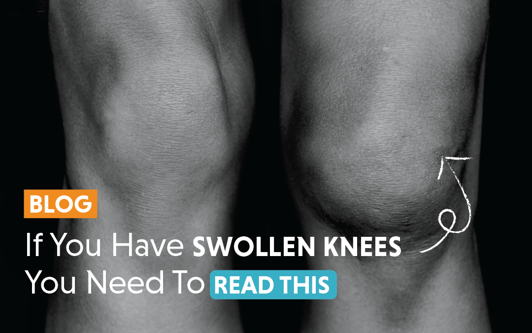 viscogen if you have a swollen knee you need to read this