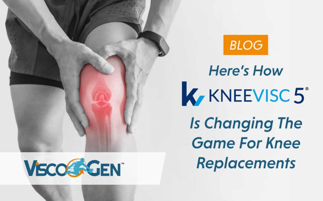 Here’s How KneeVisc 5® is Changing the Game for Knee Replacements