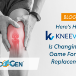 Here's How KneeVisc 5® is Changing the Game for Knee Replacements