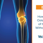 How to Treat Osteoarthritis of the Knee without Surgery