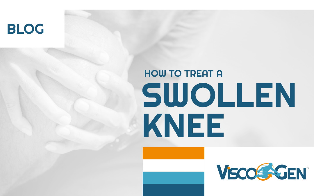How to Treat a Swollen Knee