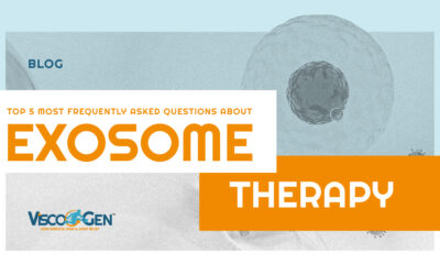 Top 5 Most Frequently Asked Questions About Exosome Therapy